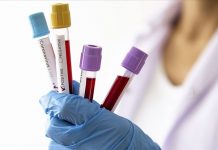 Yoğun bakımda covidli hasta sayısı 1200’e dayandı