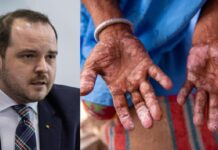 Romanya’da 44 yıl sonra ilk ‘cüzzam vakaları’ görüldü